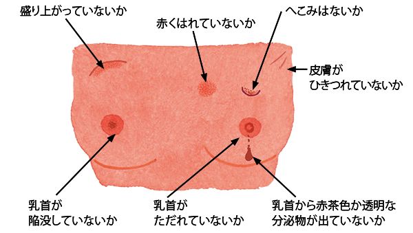 3ページ目 女性のがん第1位 乳がん患者は20年前の2 5倍と増加 セルフチェック法と予防する生活習慣 健康 婦人公論 Jp