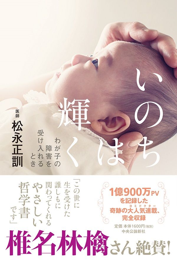 【書評】障害や病を持った子どもを授かったとき、あなたは… ~『いのちは輝く』